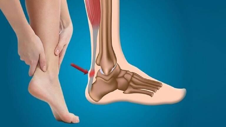 علماء يبتكرون طريقة لعلاج الإصابات المعقدة في الجهاز العضلي الهيكلي