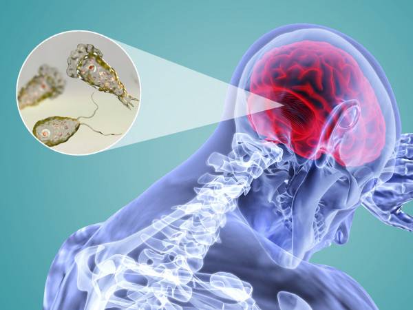 كوريا الجنوبية تعلن عن أول حالة إصابة بـ "الأميبا آكلة الدماغ"