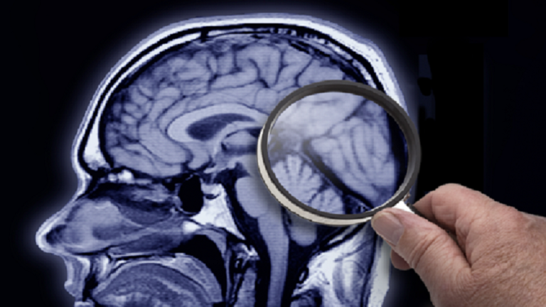 علماء بطرسبورغ يبتكرون عقارا يحفظ الذاكرة