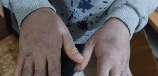 تحرير طفلين تعرّضا للتعنيف اليومي
من قبل والدهما وزوجته... وتوقيف الفاعلَين