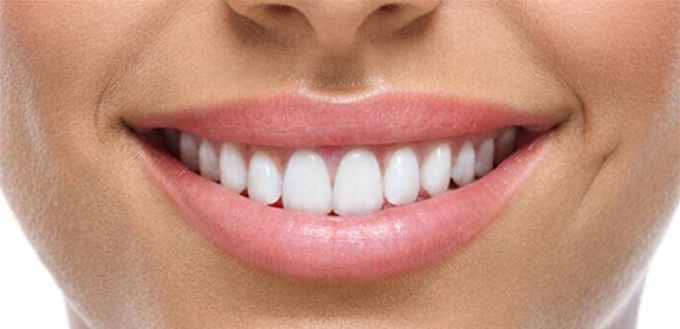 لون الأسنان... لماذا يتعيّر الى الأصفر؟