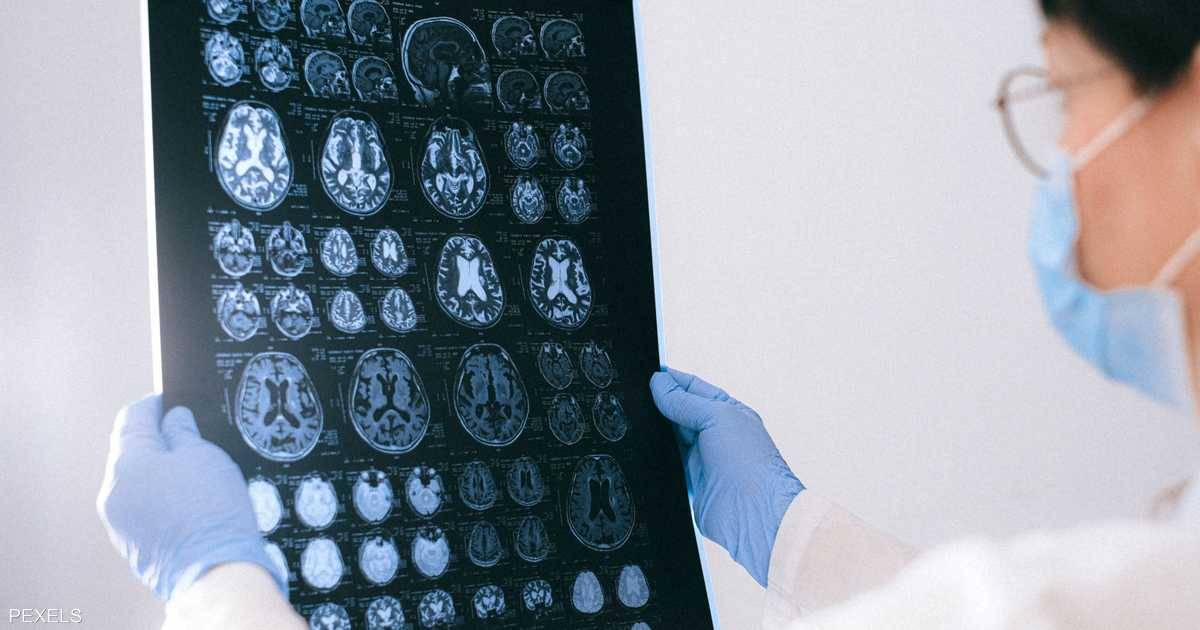 إليكم كمية المياه التي يحتاجها الجسم للتقليل من خطر الإصابة بالسكتة الدماغيّة!