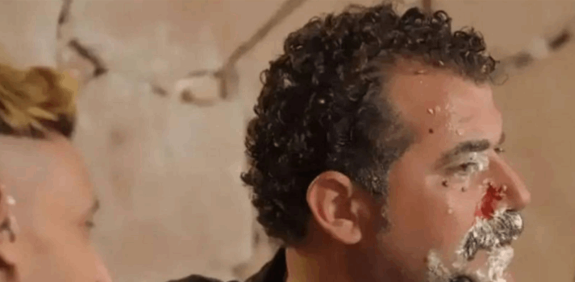 دماء وإصابة في الوجه في حلقة محمود حافظ مع رامز جلال