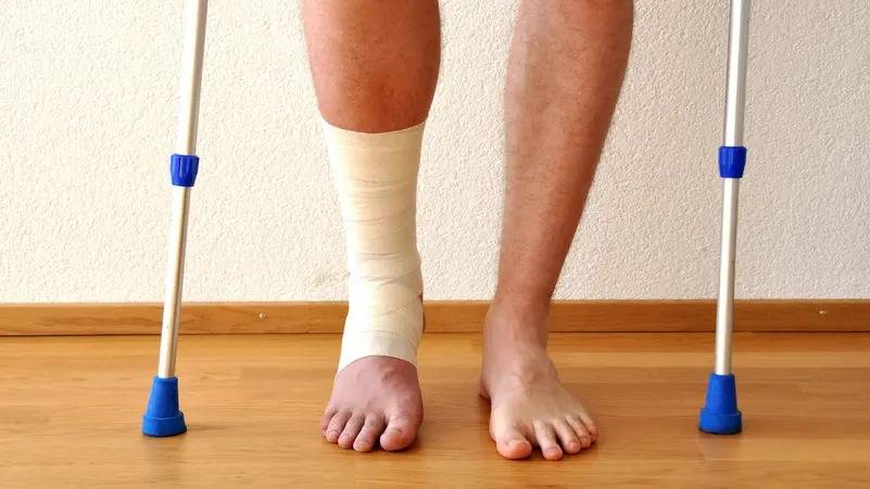 تبريد أنسجة العظام يسرع الشفاء من الكسور