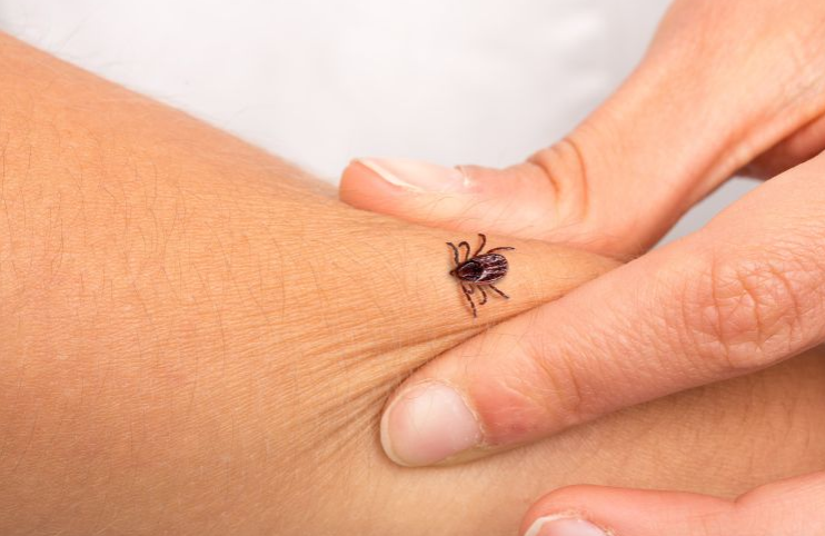 تعرّض الأطفال لدغة القراد خلال الصيف قد تسبب أمراضا خطيرة... خبراء يحذّرون