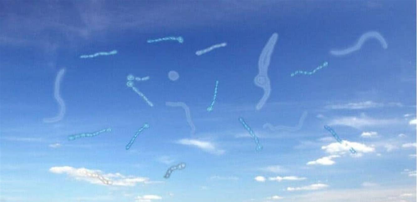 سبب خطير لظهور "الذباب" أمام العينين.. ما هو؟