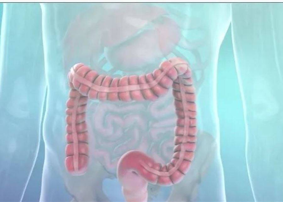 القولون العصبي.. نصائح ستخفف مشقة المتلازمة المؤلمة