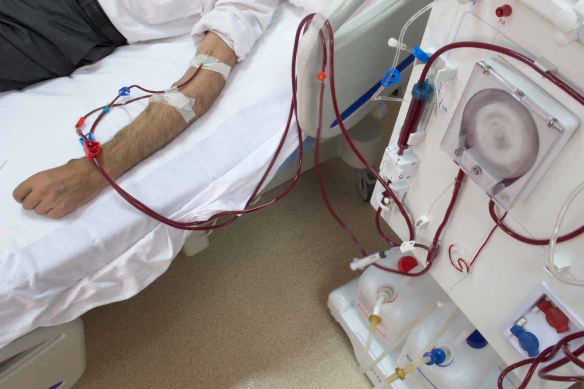 آلية جديدة لمرضى غسيل الكلى