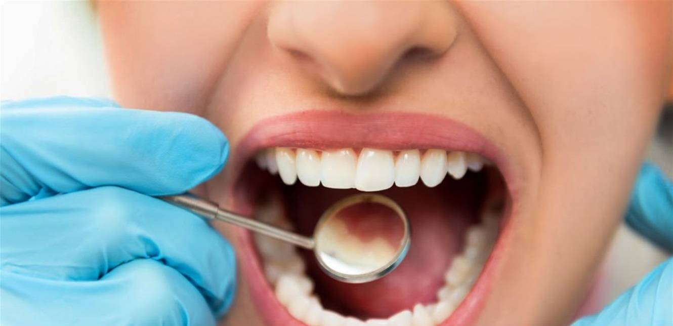 هذه عواقب عدم علاج تسوس الأسنان