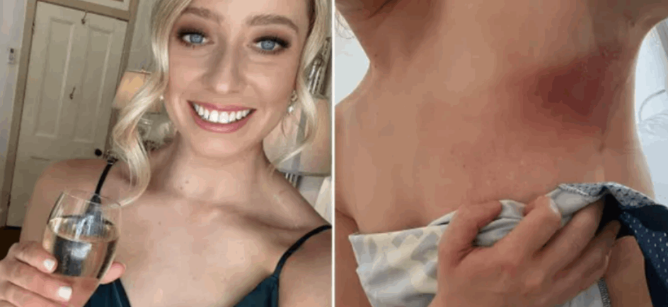 اكتشفت إصابتها بالسرطان خلال زفاف صديقتها المفضلة.. وهذا ما حصل معها!