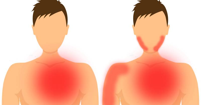 كيف تفرّق بين الألم العصبي والنوبة القلبيّة؟