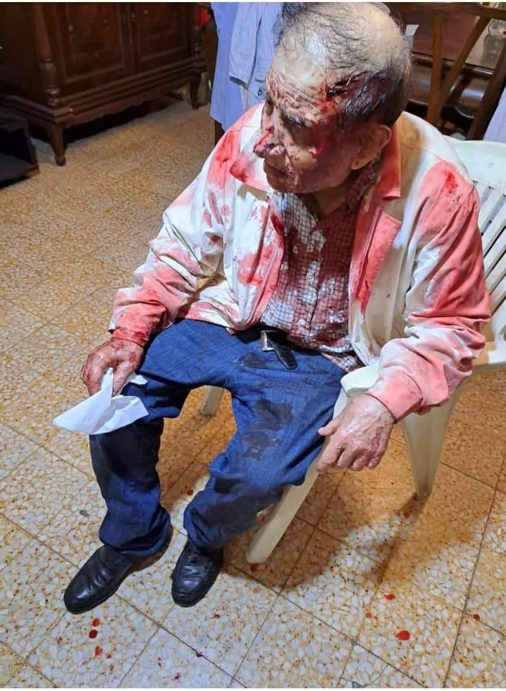 اعتداء وحشي وسلب في جونيه... والضحيتان يملكان محل صيرفة