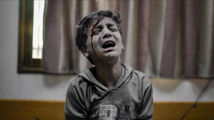 شهداء غزة تخطوا ال20 الفا