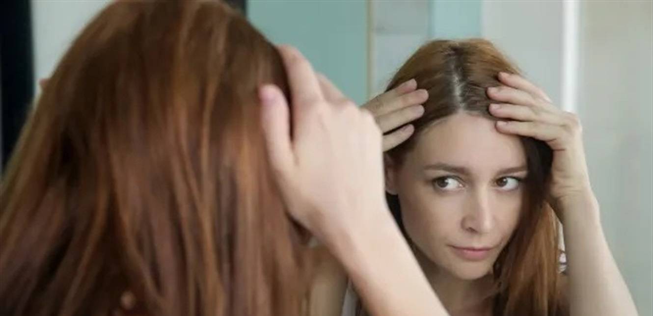 5 أسباب رئيسية تؤدي إلى تساقط الشعر.. تعرفوا عليها