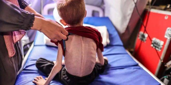 “هيومن رايتس ووتش”: التجويع هو سلاح يقتل الأطفال