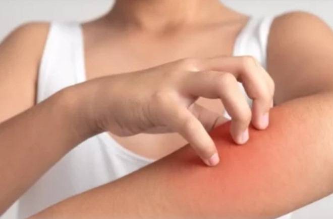 أعراض الحساسيّة المخفيّة... علامات تحذير قد لا تعرفها