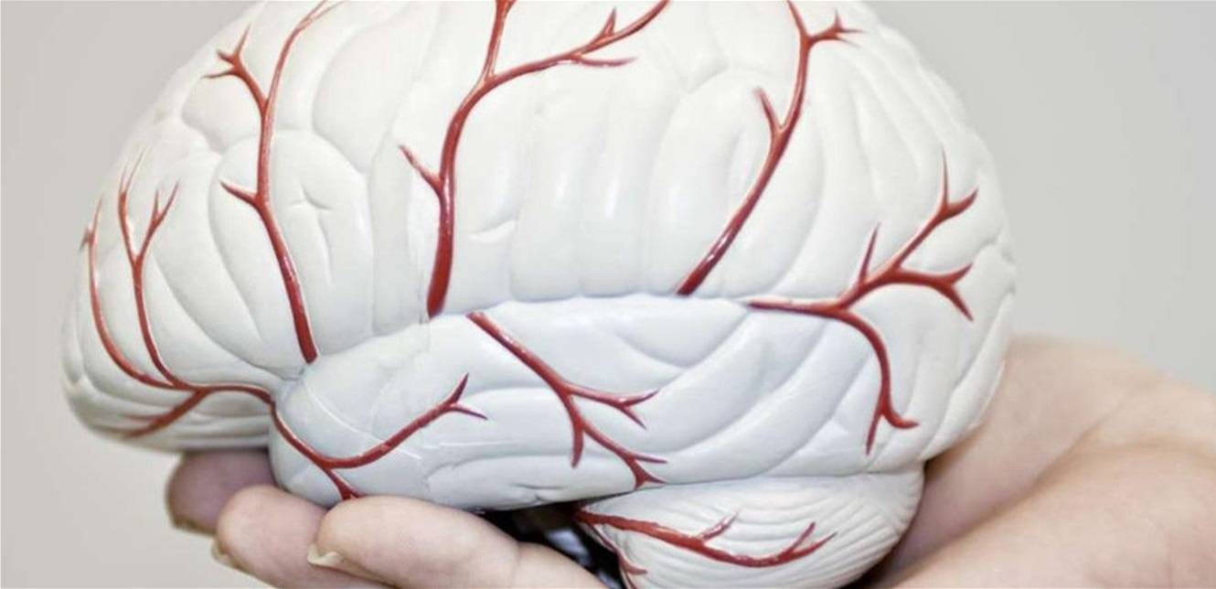 تطوّر كبير.. الذكاء الإصطناعي قد يبدأ بمعالجة شرايين الدماغ!