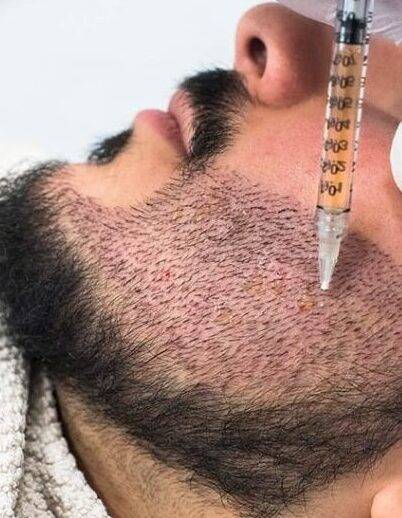 زراعة الشعر في لبنان واحدة من أكثر العلاجات التجميليّة طلباً
أرقام الوافدين تبشر بالخير والإيرادات "طلوع"... فهل تروّج وزارة السياحة لهذا القطاع؟