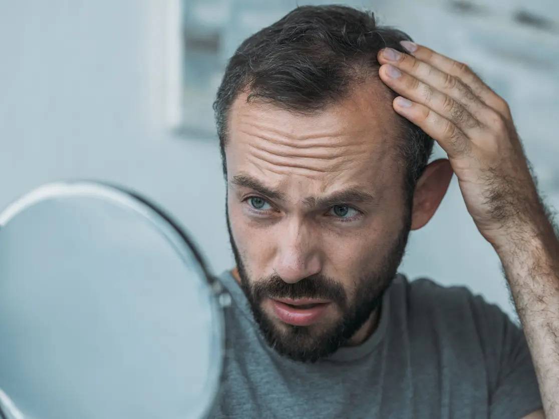 عن طريق الصدفة... اكتشاف علاج ثوري للصلع والسر في السكر!