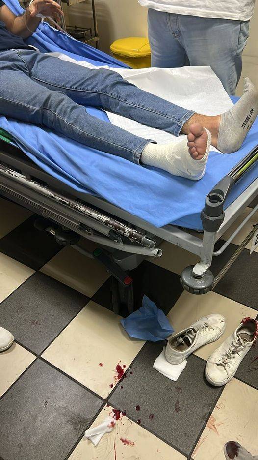 إطلاق نار... وسقوط جريح في أبي سمراء