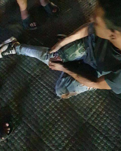 أطلق النار عليه... وأصابه في قدمه