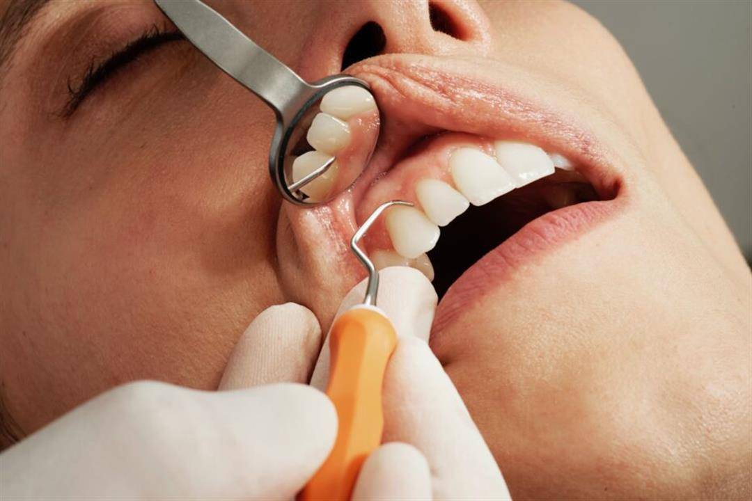 كيف يؤثر تسوّس الأسنان على صحة القلب والجسم؟