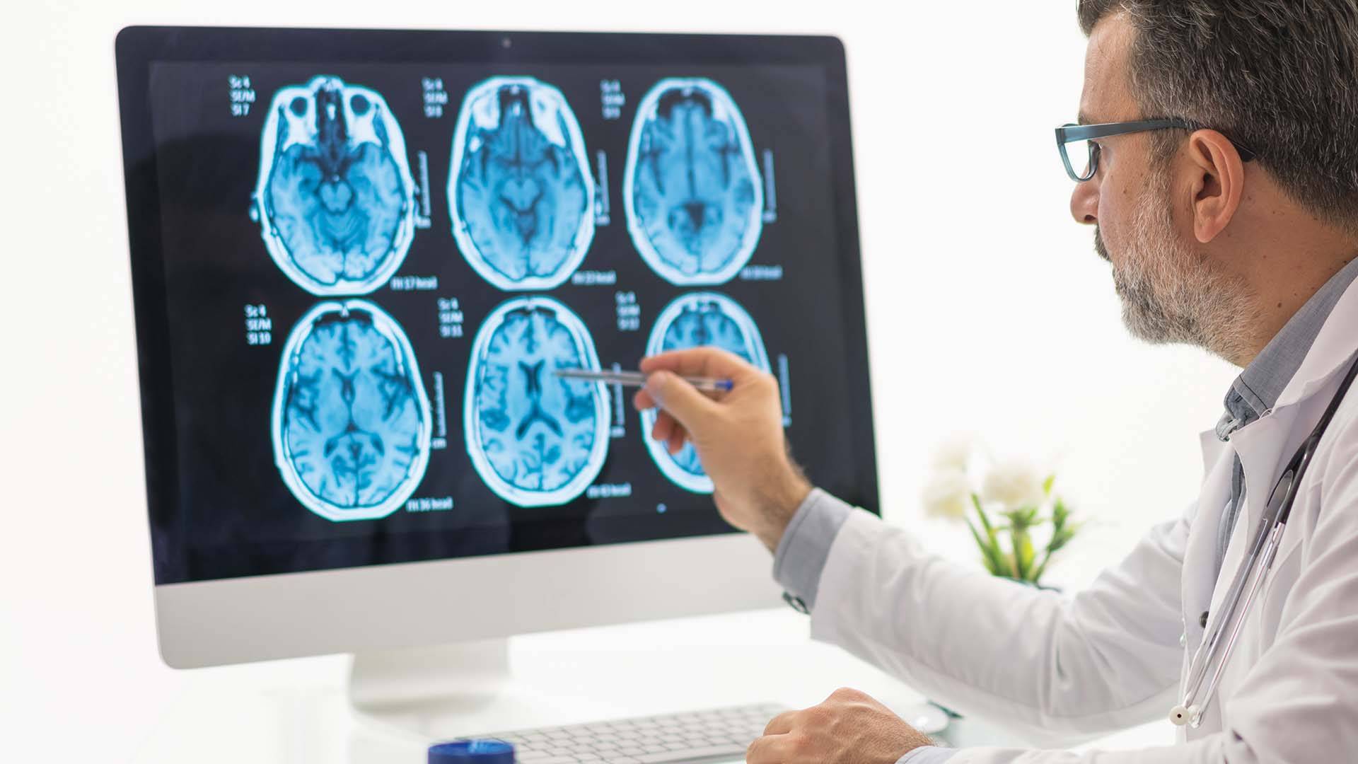 التهاب الدماغ: الأسباب المختلفة وتأثيراتها الصحيّة