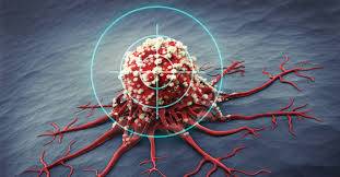 الأورام الحميدة: هل يمكن أن تتحوّل الى أورام سرطانيّة؟