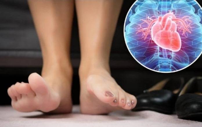 كيف تعكس صحّة قدميك مُؤشرات خفيّة لأمراض القلب؟