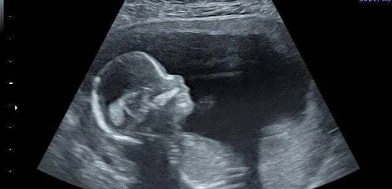 خبر حزين.. ممثلة تفقد جنينها في الأسبوع الـ 22 من الحمل