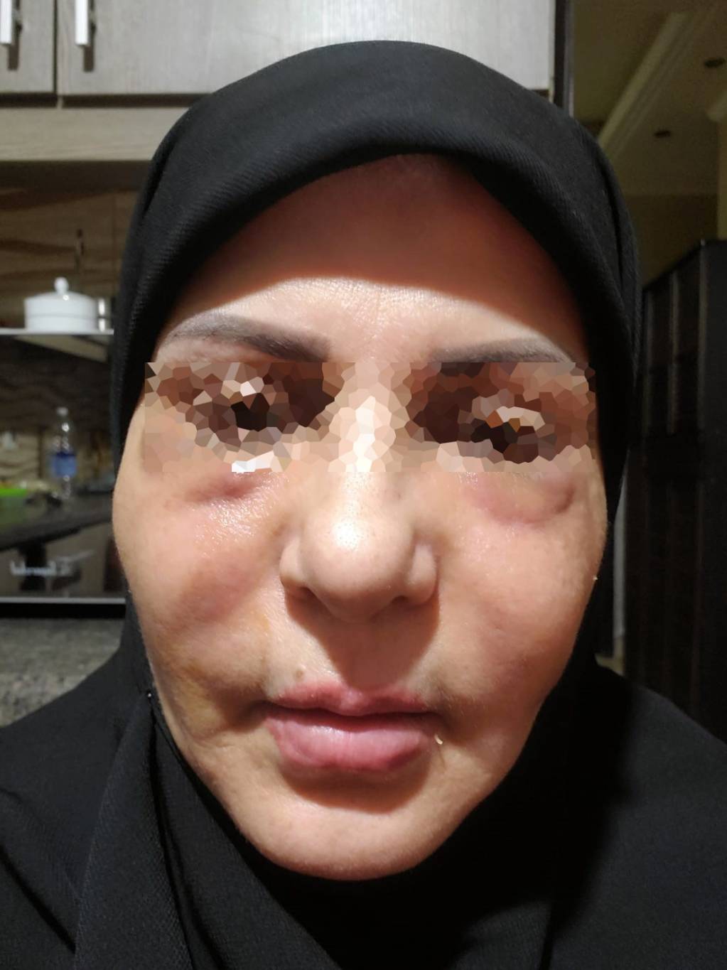 مُمارسات غير قانونيّة ترتكب باسم "الجمال"... تجارة مُربحة... والطب براء من مُنتحلي الصفة