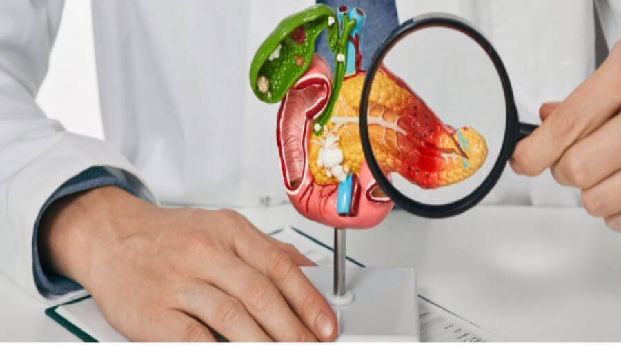 البنكرياس تحت المجهر: كيف تكتشف أمراضه مبكرًا وتحمي نفسك؟