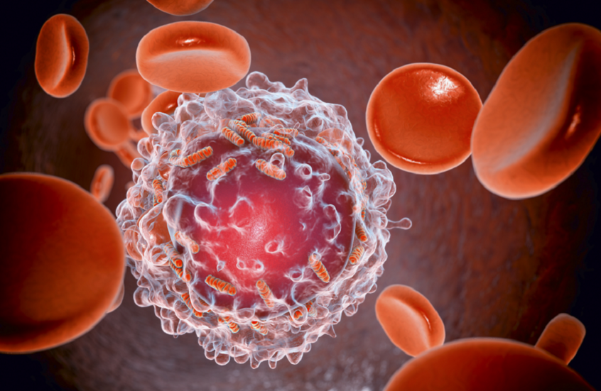 اكتشاف نقطة ضعف جديدة في الخلايا السرطانية تفتح آفاق علاج سرطان الدم