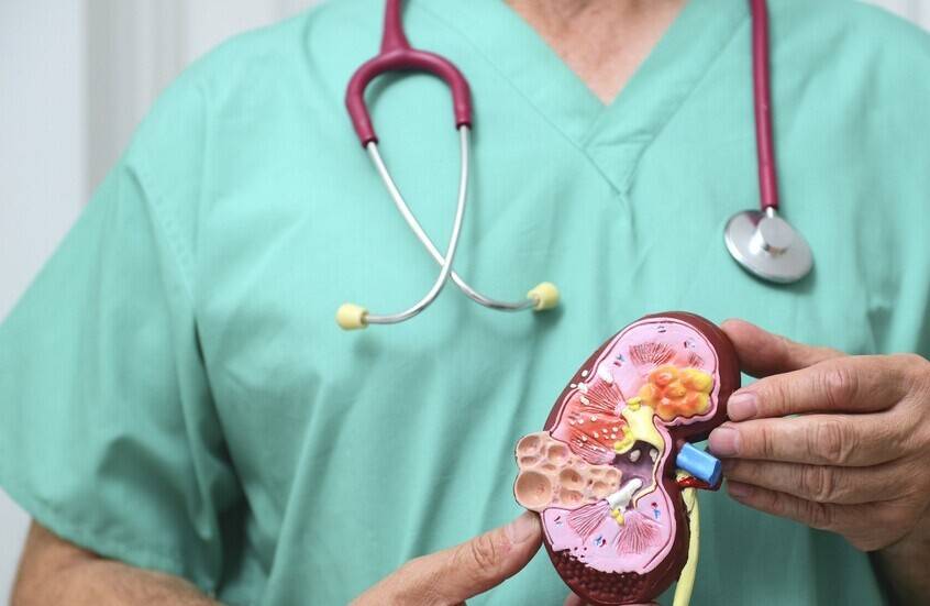 علامات خفية لأمراض الكلى