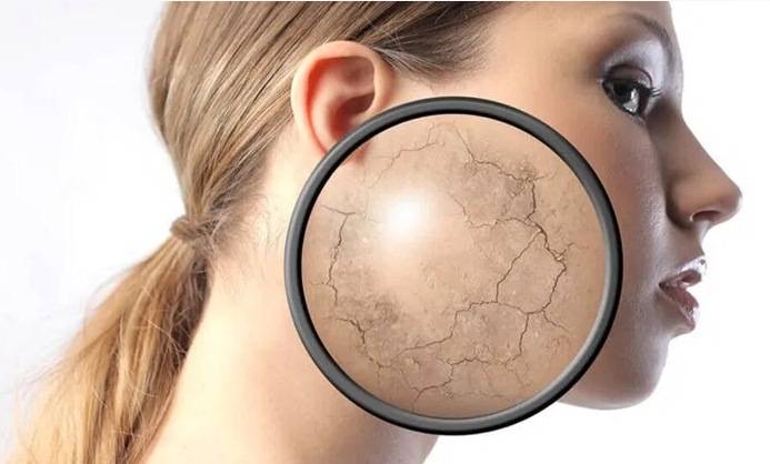 التوتر النفسي وبشرة الإنسان... علامات وتداعيات لا يُمكن تجاهلها!