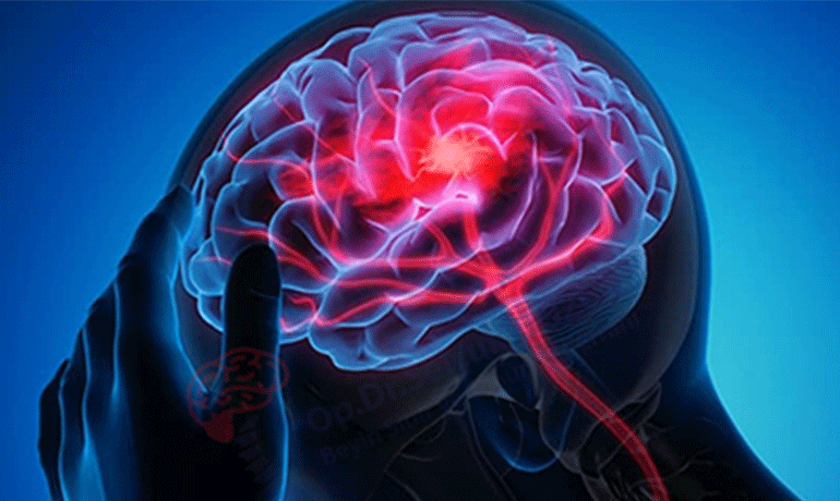 ‫هكذا تحافظ على شباب دماغك