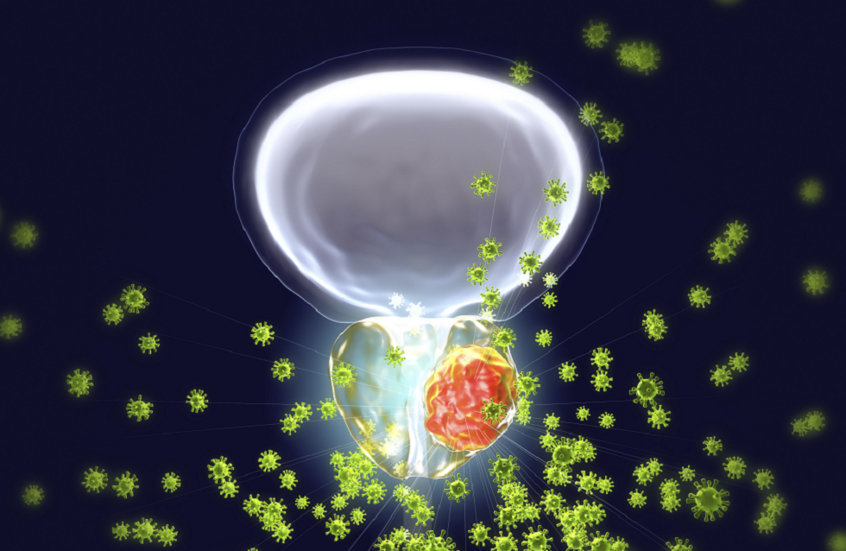 تلوث الهواء يزيد خطر الإصابة بسرطان البروستات لدى الرجال