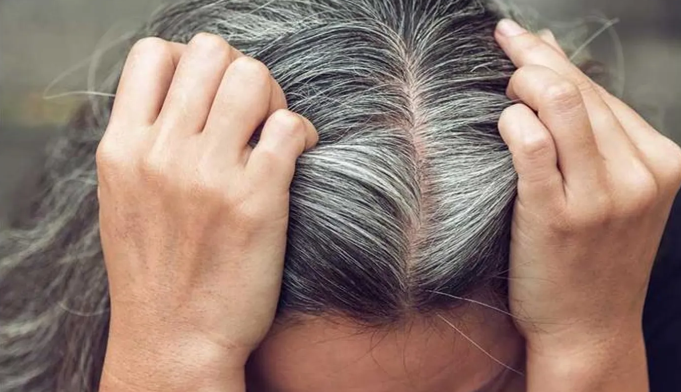 طرق طبيعية للتقليل من الشيب واستعادة لون الشعر بدون صبغات كيميائية