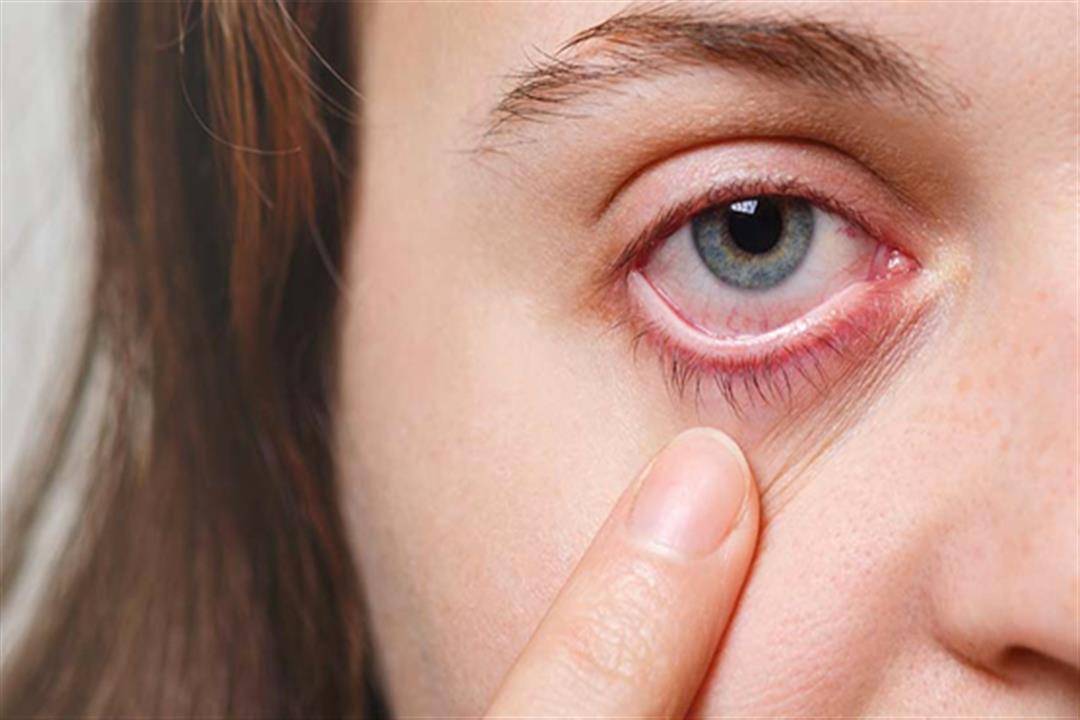 للوقاية من العمى الدائم... إنتبهوا لهذا الأمر!