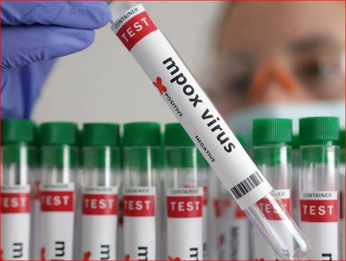 الصحة العالمية: حالتان مؤكّدتان لسلالة مؤتلفة من mpox في بريطانيا والهند