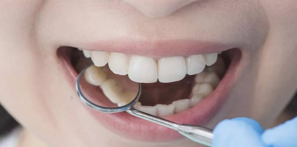 أطعمة متهمة ظلماً… 6 مفاجآت لأسنان أقوى