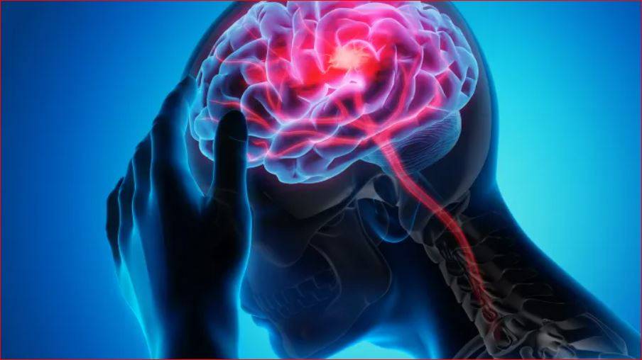 الكثافة العمرانية تقلل خطر السكتة الدماغية؟