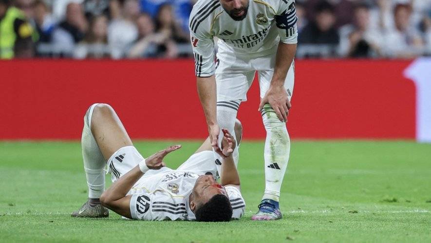 مبابي يغيب عن تدريبات الميرينغي بداعي الاصابة