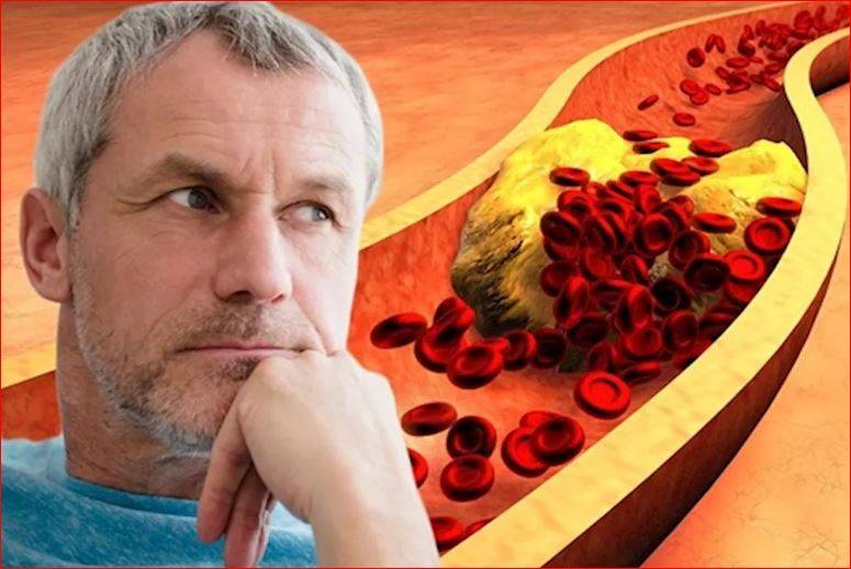 طرق طبيعية لعلاج الكوليسترول عند الرجال