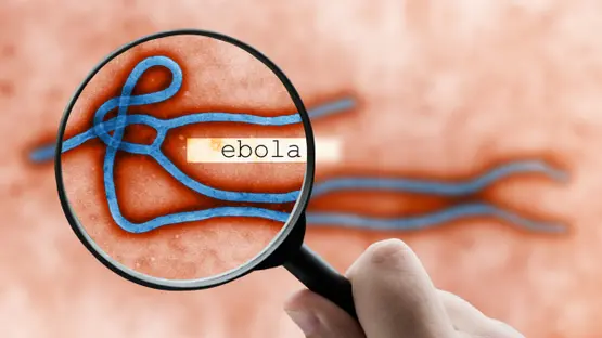إيبولا يتمدد في الكونغو.. 321 إصابة مؤكدة و41 وفاة