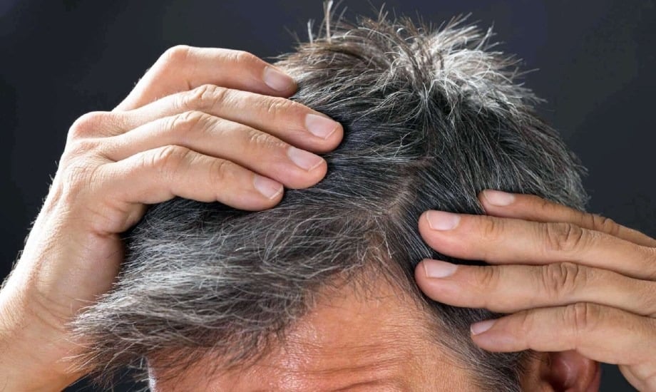 الشيب عند الرجال... متى يبدأ وما العوامل التي تسرّع ظهوره؟
