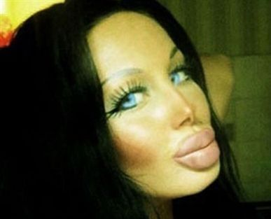 بعد 13 عمليّة تجميل... هذه هي النتيجة