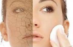 طرق علاج جفاف البشرة في الشتاء