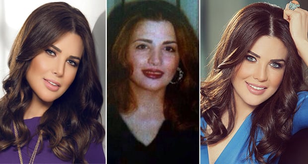بالصورة – منى أبو حمزة قبل التجميل!