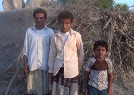 في اليمن إناث يتحولن الى ذكور